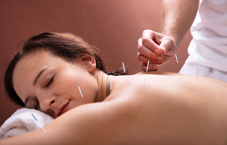 Servicio de Acupuntura